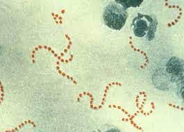 Scarlet fever and Streptococcus  A (Strep A)
